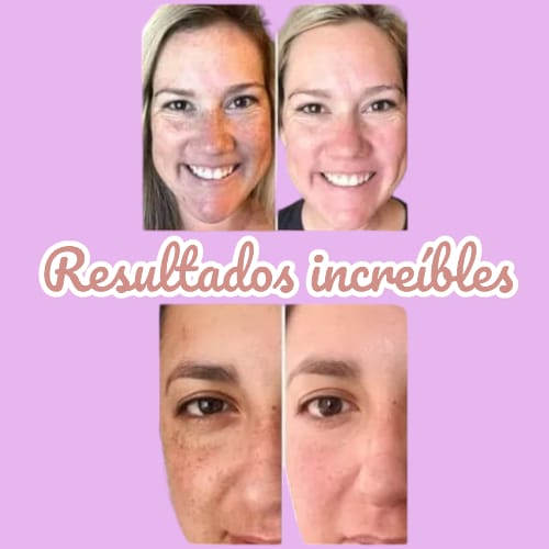 HANNA´S SKIN CARE™ - Tónico Mágico Aclarante 100% efectivo