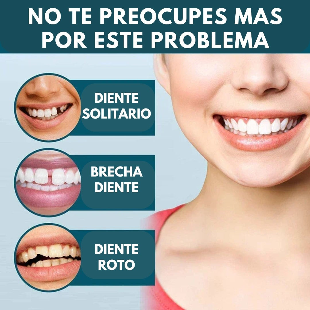 SMILE REVIVE™ - CARILLAS DENTALES