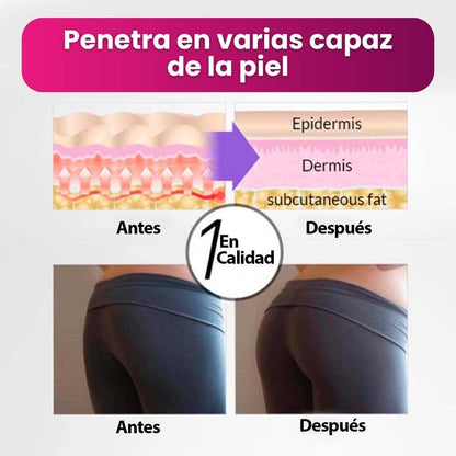 HIP UP™- CREMA REAFIRMANTE DE GLÚTEOS