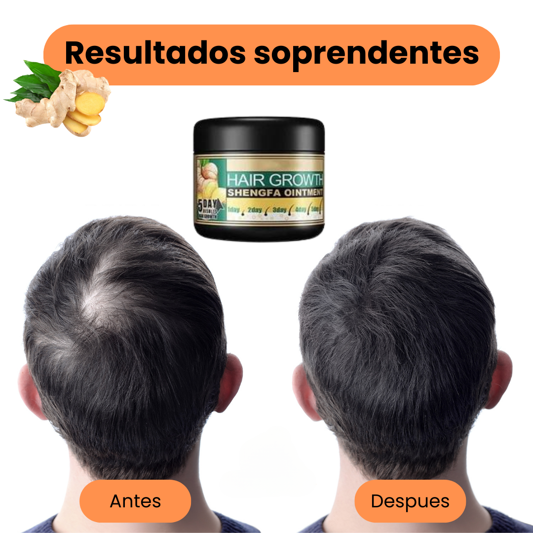 HAIR GROWTH™ - CAPILAR CRECE CABELLO