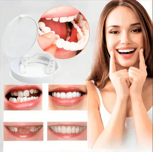 SMILE REVIVE™ - CARILLAS DENTALES